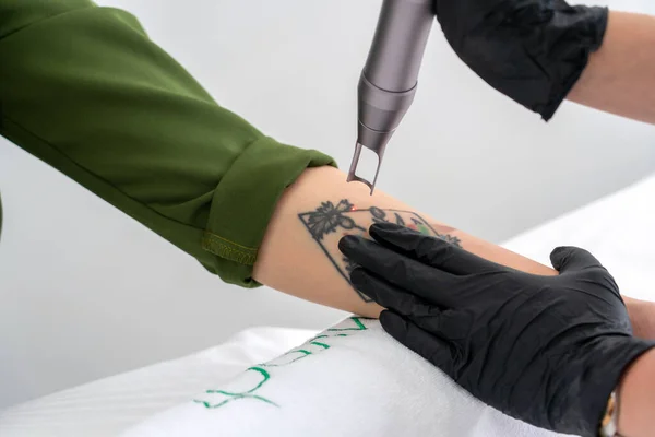 Cosmetologist usando dispositivo laser para remover uma tatuagem indesejada do braço feminino. Conceito de apagar tatuagens como um procedimento caro em uma clínica de cosmetologia — Fotografia de Stock