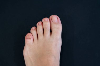 Siyah arka planda iki küçük ayak parmağı olan kadın ayakları.