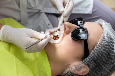 Dentist Examining Patients Mouth with dental mirror In Clinic. Checkup concept