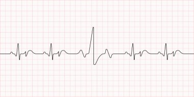 Elektrokardiyogram. Kalp atışı. Tıbbi sağlık sembolü