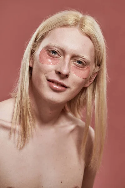 Desnudo caucásico chico con bajo ojo parche en la cara — Foto de Stock