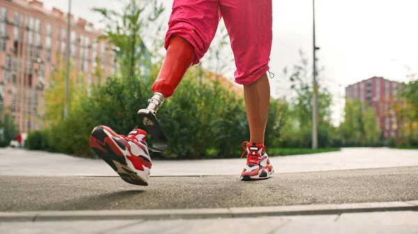 Parcial de menina com perna artificial indo na estrada — Fotografia de Stock