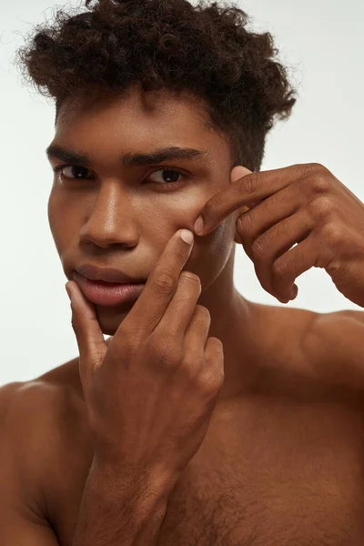 Partial Serious African American Guy Squeezing Pimple His Face Young — Stockfoto