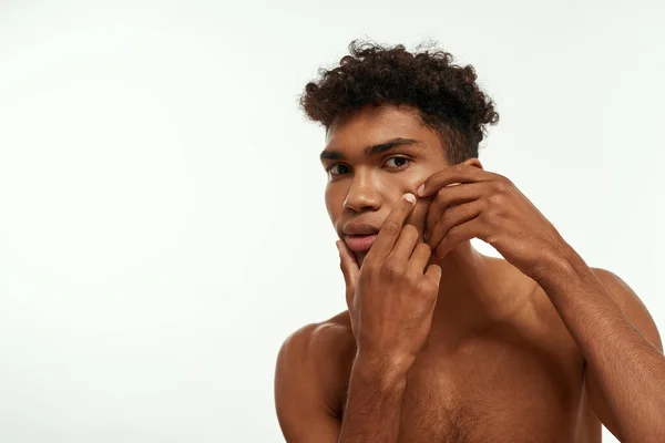 Cropped Serious Black Guy Squeezing Pimple His Face Young Slim — Stockfoto