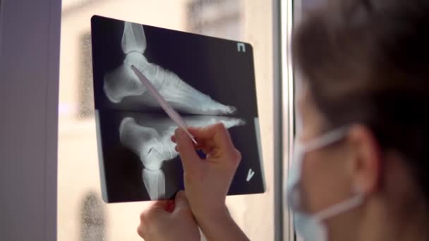 Läkaren undersöker röntgenfilm av bruten fot — Stockvideo