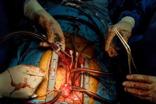 Chirurg Operationssaal Während Der Operation Mit Operationsausrüstung — Stockfoto