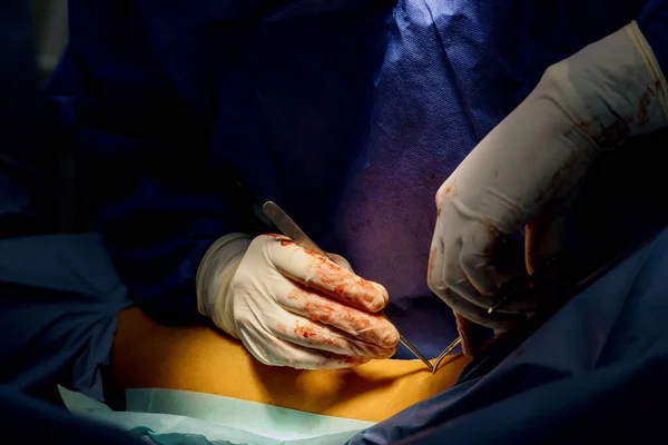 Médico Cirujano Preparó Pierna Para Cirugía Con Sala Operaciones Emergencia — Foto de Stock