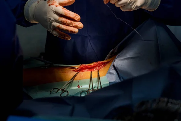 外傷外科手術室手術のための脚を準備医師と緊急手術室 — ストック写真