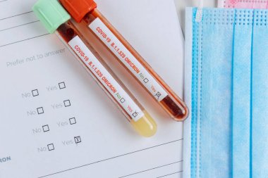 COVID-19 için teşhis testi. Omicron 'un yeni versiyonu. Laboratuvarda tıbbi bilimler uzmanı test tüpü alıyor.