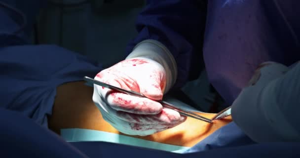 Cirujano realiza una operación en la pierna del paciente, corta la piel con un bisturí manos de un médico con instrumentos médicos en el quirófano . — Vídeos de Stock