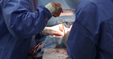 Cerrah ve ekip akciğer kanserine karşı göğüs ameliyatı yapıyor.