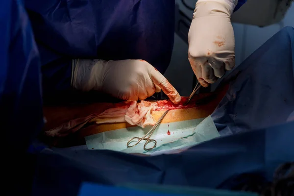 Doctor Surgeon Making Surgery Hospital Operating Room Open Wounds Leg — Stock Photo, Image