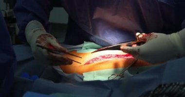 Doktor cerrah iç müdahale için ameliyat sırasında ayak kesti