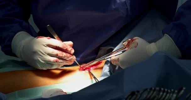 Operating during surgery with cutting legs for internal intervention — Stockvideo