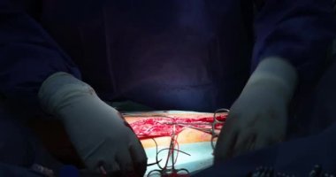 Ameliyathane iç müdahale için bacak kesiyor