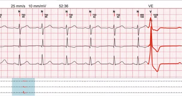 Primo piano di un elettrocardiogramma in forma digitale — Video Stock