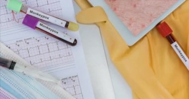Deri içindeki dijital tabletteki hastanın doktor teşhisi maymun çiçeği virüsü için enfekte olmuş bir kan örneğini isilik yapıyor.
