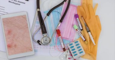 Maymun Çiçeği için yeni virüs salgını. Deri döküntüleri içindeki doktor muayenesi hastası dijital tablete bakıyor. Bir tüp kan testi.