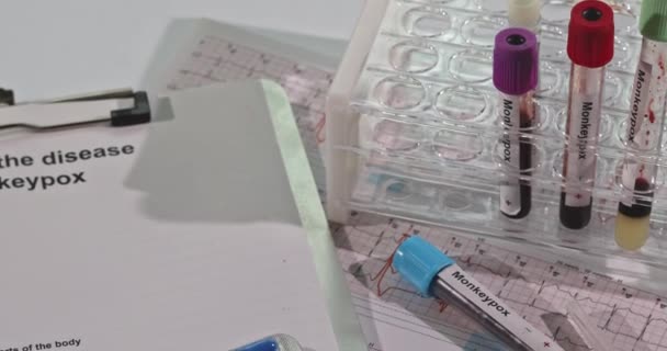 Laboratorium Check Analyse Bloedtest Voor Pokken Monkey Infectie Bloedtest Nieuwe — Stockvideo