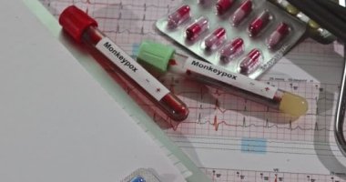 Çiçek hastalığı için kan tahlili laboratuvarı. Maymun enfeksiyonu. Yeni salgın virüsünün kan testi.