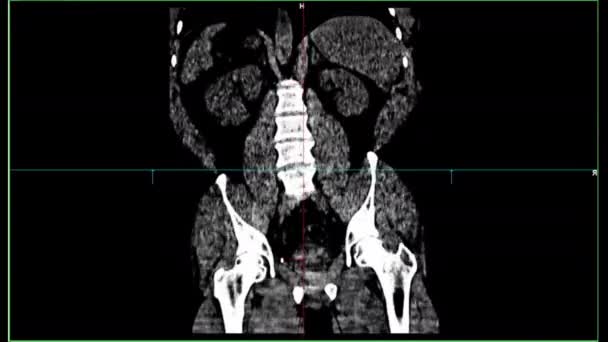 Specjalny Sprzęt Medyczny Tomografii Dane Diagnostyczne Mri Ekranie Laboratoryjnym Badań — Wideo stockowe