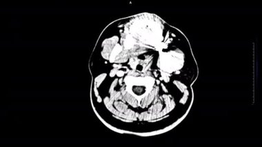 Tıbbi tanı MRI taramaları klinik analiz için CT tarayıcısı ile insan hastalığı araştırması