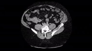 İnsan hastalığının klinik analizi için X-ışını görselleştirme tıbbi teşhis MRI taramaları