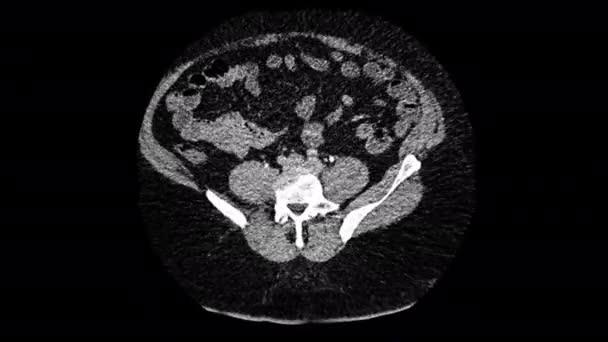 Visualizzazione Raggi Diagnostica Medica Risonanza Magnetica Analisi Clinica Della Malattia — Video Stock