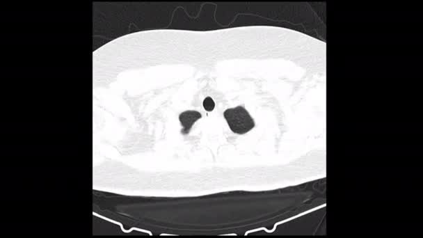 Medizinische Spezialgeräte Zur Erforschung Menschlicher Krankheiten Mrt Diagnosedaten Auf Labortomographie — Stockvideo