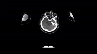 Manyetik rezonans MRI görüntüleme üzerinde insan hastalıkları analizinin ekran bilgisayarı