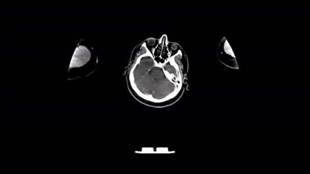 Ekran Komputerowy Analizy Chorób Człowieka Rezonansie Magnetycznym Rezonansu Magnetycznego — Wideo stockowe