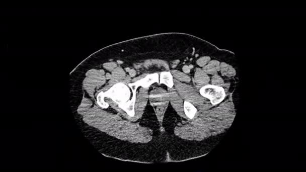 Visualisasi Ray Head Views Mri Scan Human Disease Medical Examination — Stok Video