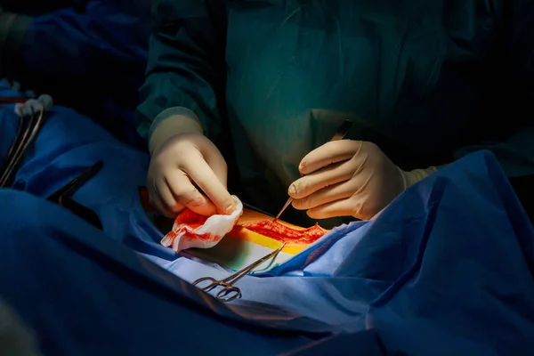 Médico Cosiendo Una Herida Una Pierna Después Una Lesión Quirófano — Foto de Stock