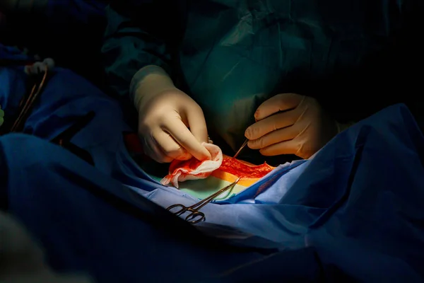 Orvosok Műtőben Összevarrták Lábát Miután Megsérült Kórházban — Stock Fotó