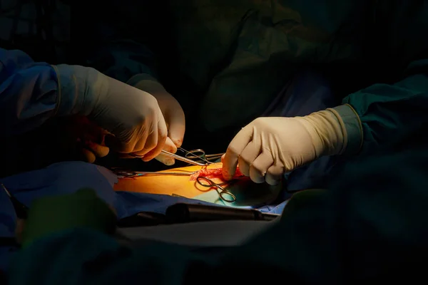 Operating Room Doctor Sews Wound Leg Injured Patient Surgery — Stock Photo, Image