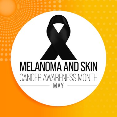 Melanoma ve cilt kanseri her yıl Mayıs ayında gözlemlenen ultraviyole ışınlara (UV) maruz kalma, en ölümcül cilt kanseri türü olan melanom vakalarının çoğuna neden olur. Vektör illüstrasyonu.