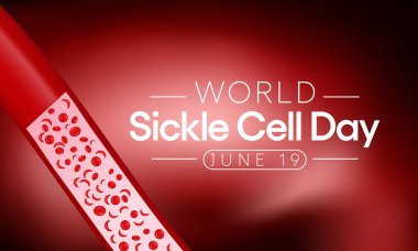 Dünya Orak Hücre Günü her yıl 19 Haziran 'da gözlemlenir. Bu, vücut boyunca oksijen taşımak için yeterli sayıda sağlıklı hücrenin bulunmadığı kalıtsal bir alyuvar hastalığıdır. Vektör illüstrasyonu