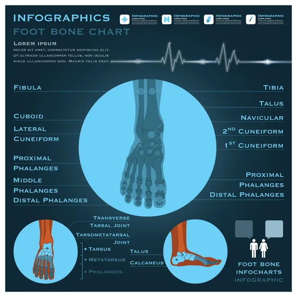 Infografías de Pie Hueso Salud y Medicina — Archivo Imágenes Vectoriales