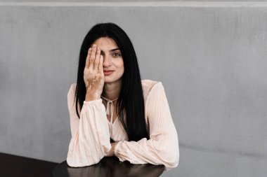 Ellerinde vitiligo pigmentasyon bantları olan Gürcü kadın elleriyle yüzünü örtüyor. Deri hastalıkları olan yaşam tarzı