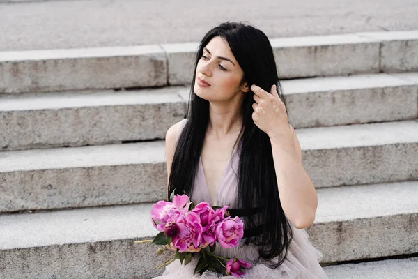 Woman with vitiligo skin pigmentation on the hands holidng bouquet of flowers peonies. Skin seasonal diseases