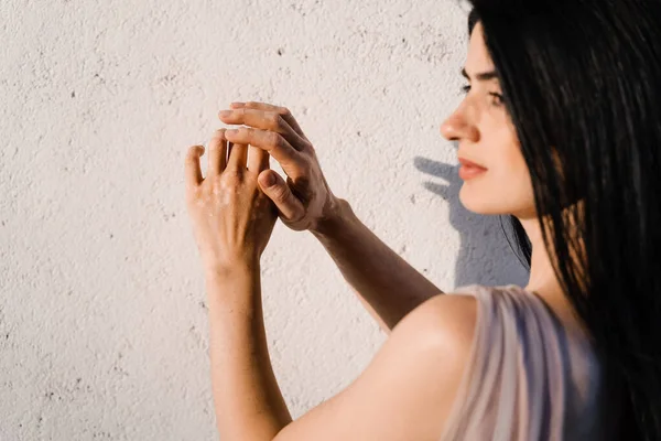 Gürcü güzel bir kadının ellerinde vitiligo derisi pigmentasyonu. Deri mevsimsel hastalıklar. Kız ellerini vitiligo lekeleriyle kaplamış olarak görüyor.