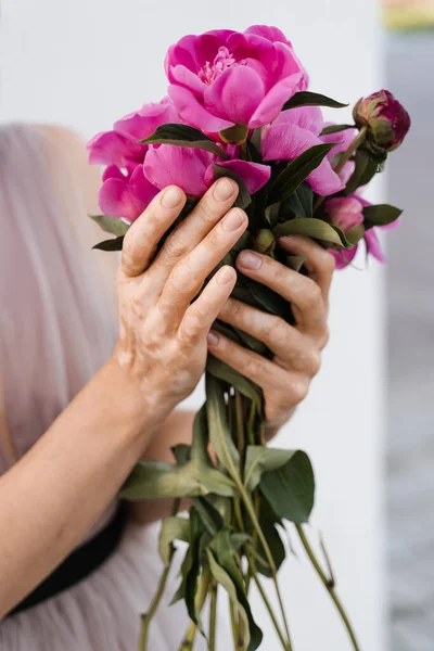 Hands with vitiligo skin pigmentation and bouquet of flowers peonies. Skin seasonal diseases