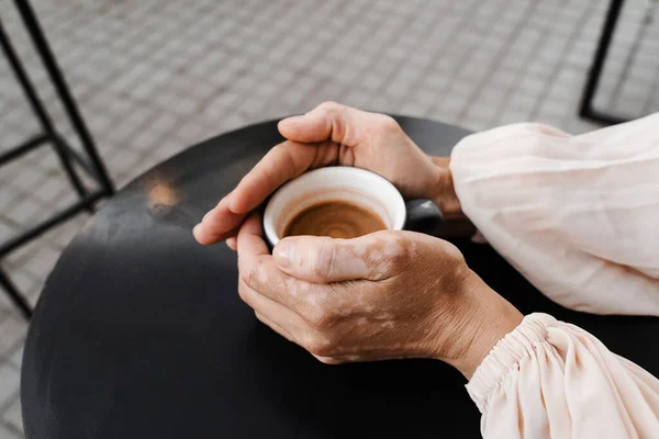 Hands with vitiligo skin pigmentation holding cup of coffee close-up. Lifestyle with skin seasonal diseases