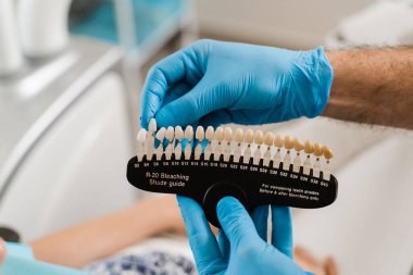 Diş rengi gölgeler yakın çekim rehberidir. Diş hekimliği. Diş macunları ya da implantlar diş sağlığı kliniğindeki kadın hastalara diş beyazlatma için uygun renk örnekleri.