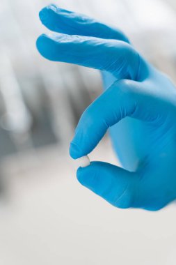 Kaplama diş implantı. Diş hekimliği. Diş implantasyonu ve beyazlatma hakkında dişçiye danışıyorum.