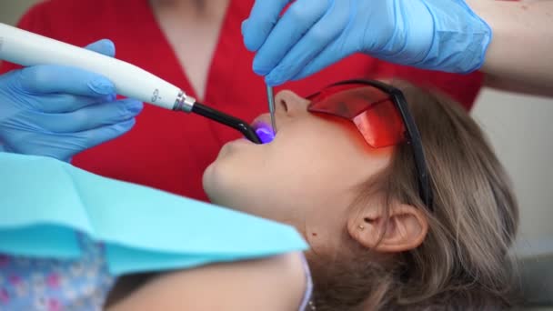 Child Dentistry Illumination Photopolymer Tooth Filling Procedure Video Pediatric Dentist — Video