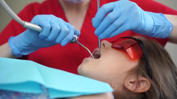 Dentysta Dziecięcy Leczy Usuwa Próchnicę Pacjenta Nagranie Oświetlenie Fotopolimerowej Procedury — Wideo stockowe