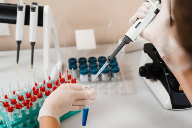 Laboratuvarda mikrodozeri olan bir laboratuvar asistanı kan tahlili yapıyor. Laboratuvarda tıbbi malzemeler. Kan emici bilim adamı kan analizi yapıyor.