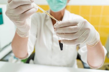 Kan plazmasının analizi. Laboratuvar asistanı elinde bir damardan çıkan kanla bir test tüpü tutuyor ve ona bakıyor. Laboratuvarda kan testi. Gözlüklü ve maskeli bir tıp uzmanı.
