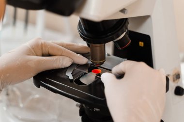Mikroskop laboratuarını kullanarak kan analizi. Tıbbi klinikte hematolojik ve biyokimyasal kan testleri için tıbbi ekipmanlar